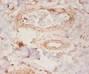 Polyclonal Rabbit anti-Human ARHGDIA / RHOGDI Antibody (IHC, WB)