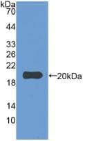 IL-1B / IL-1 Beta Antibody (aa118-268)
