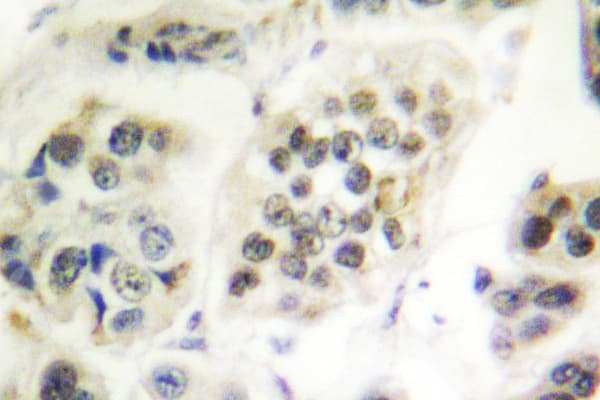 LMNA / Lamin A+C Antibody (Arg386)