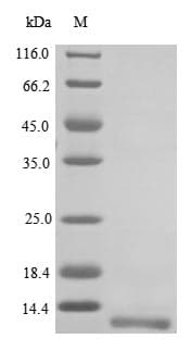 Mouse NPY2R Protein (Recombinant 10His, N-terminus)