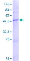 Human NICN1 Protein (Recombinant GST)