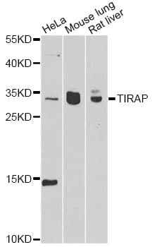 Polyclonal Rabbit anti-Human TIRAP Antibody (IHC, IF, WB)