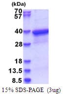 Human HLA-F Protein (Recombinant His)