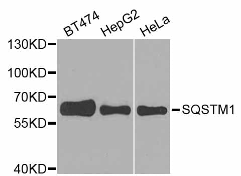 SQSTM1 Antibody