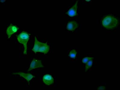PAPSS2 Antibody