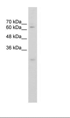 Polyclonal Rabbit anti-Human CES2 / Esterase Antibody (C-Terminus, IHC, IF, WB)