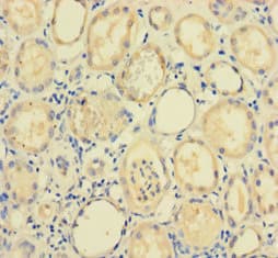 Polyclonal Rabbit anti-Human POP4 Antibody (aa1-220)
