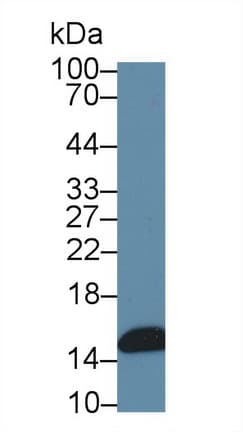 I-FABP / FABP2 Antibody (aa2-132)