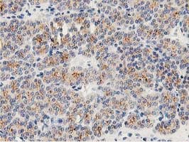 LACTB2 Antibody (clone OTI3A5)