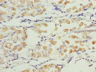 Polyclonal Rabbit anti-Human SMG6 Antibody (aa251-511, IHC)