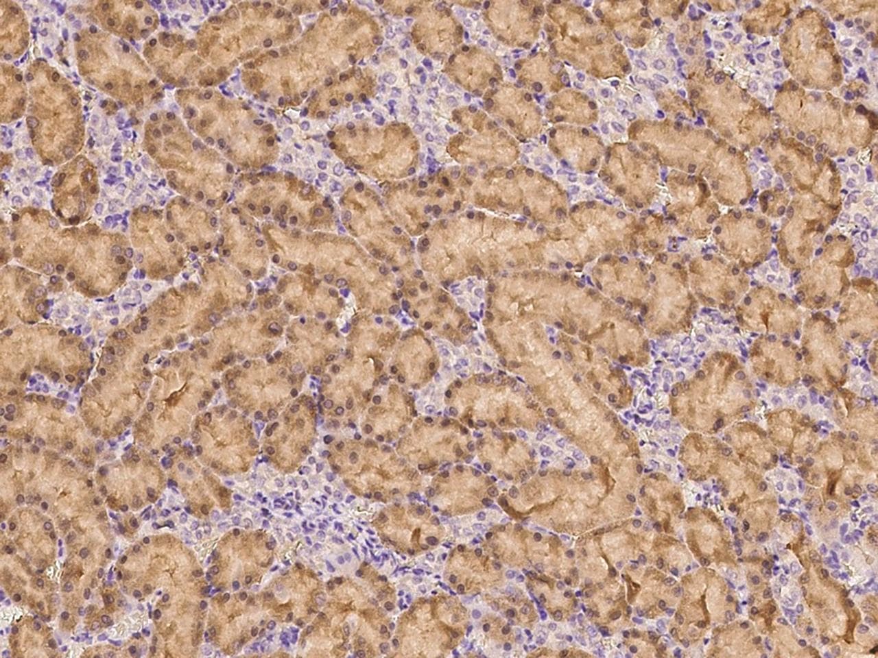 HGF / Hepatocyte Growth Factor Antibody (Preservative Free)