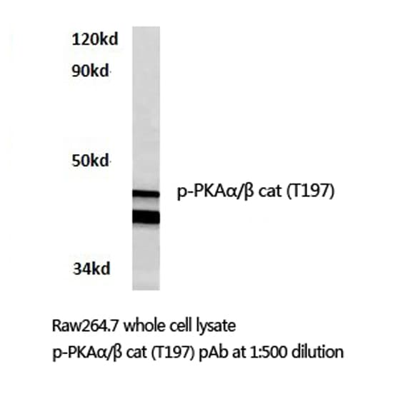 PRKACA + PRKACB Antibody (phospho-Thr197)