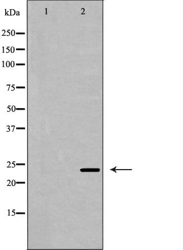 Polyclonal Rabbit anti-Human CDKN3 / KAP Antibody (IHC, IF, WB)