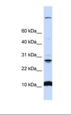 C19orf56 Antibody (N-Terminus)