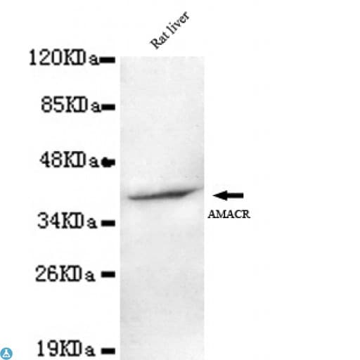 AMACR / P504S Antibody