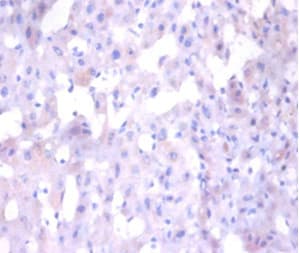 Angiogenin / ANG Antibody