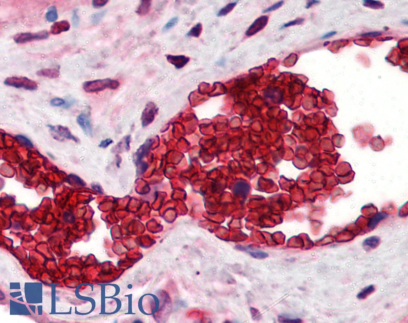 IHC-plus™ Polyclonal Rabbit anti-Human SLC4A1 / Band 3 / AE1 Antibody (N-Terminus, IHC, WB)