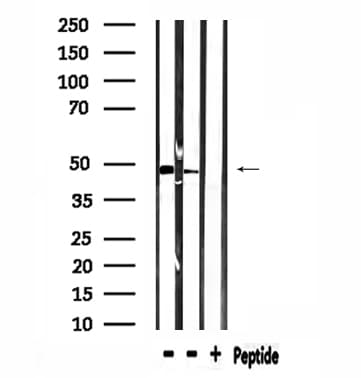 SYT13 Antibody