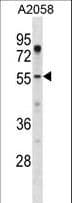 UBXD9 / ASPL Antibody (aa65-93)