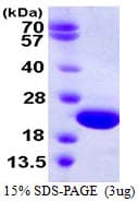 Human CRYGD / CCP Protein (Recombinant His)