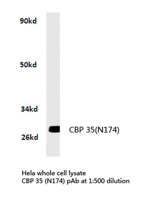 LGALS3 / Galectin 3 Antibody (aa140-190)