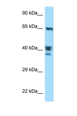 ACTL8 Antibody (aa194-243)