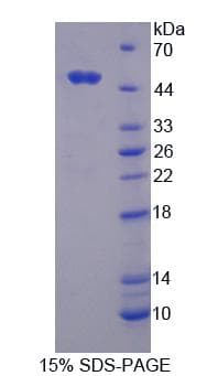 Human RNF39 Protein (Recombinant His-T7)