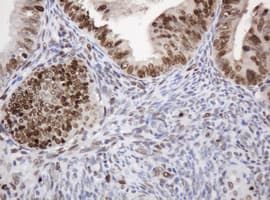 PCNA Antibody (clone OTI4G3)