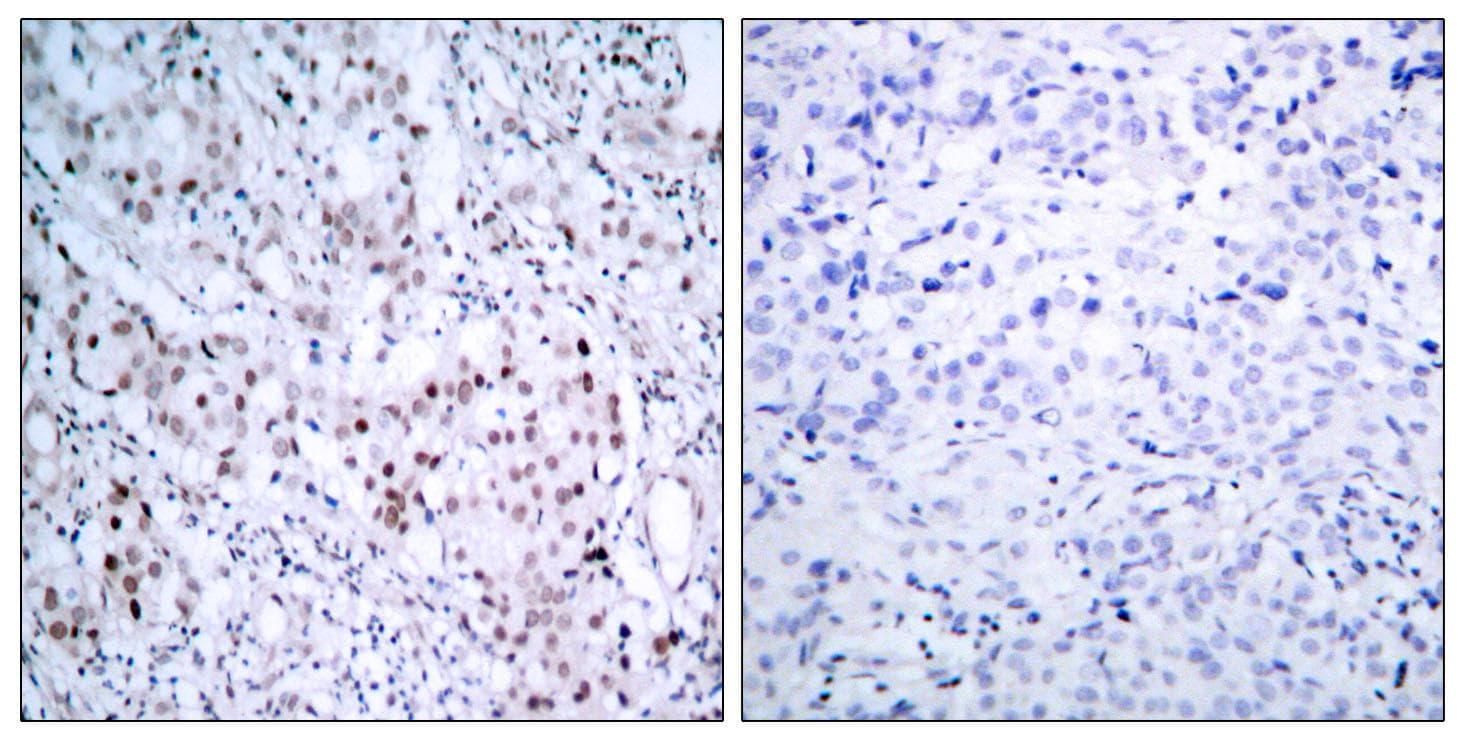 JUN / c-Jun Antibody (phospho-Ser63)