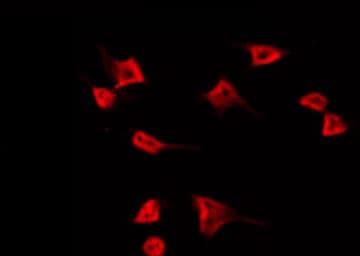 TUBGCP5 / GPC5 Antibody