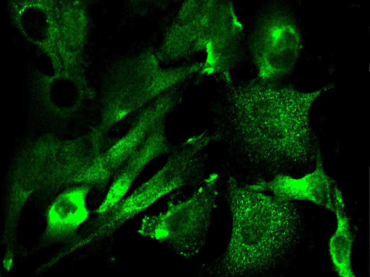 GM2A Antibody (Preservative Free)