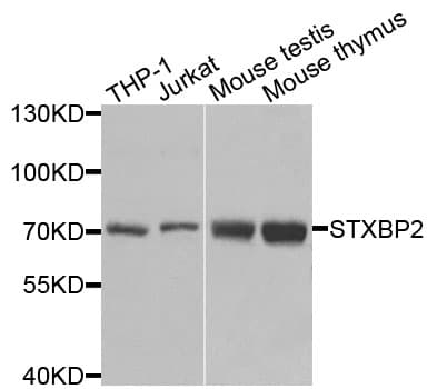 Polyclonal Rabbit anti-Human STXBP2 Antibody (IHC, IF, WB)