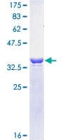Human PSMD14 Protein (Recombinant GST)