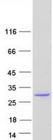 Human TESC Protein (Recombinant Myc-DDK (Flag))