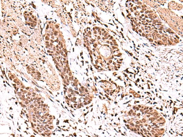 BAF53B / ACTL6B Antibody