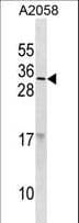 Polyclonal Rabbit anti-Human RNASE9 Antibody (aa139-167, WB)
