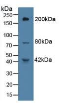 HPTPB / PTPRB Antibody (aa1041-1310)