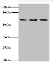 Polyclonal Rabbit anti-Human ACAD9 Antibody (aa1-270, IHC, WB)
