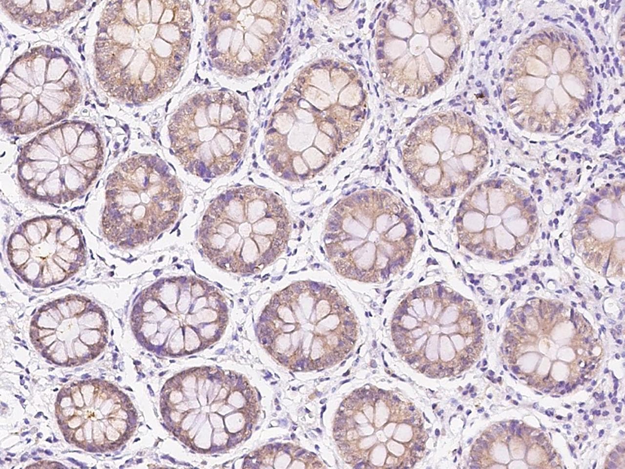 MSRA Antibody