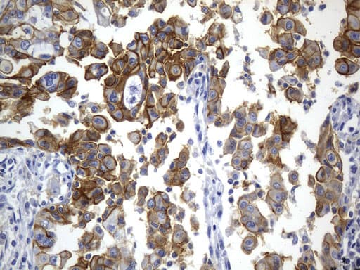 CD274 / B7-H1 / PD-L1 Antibody (aa19-290, clone UMAB229)