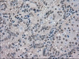 SLC18A2 / VMAT2 Antibody (clone OTI10C11, Carrier-free)