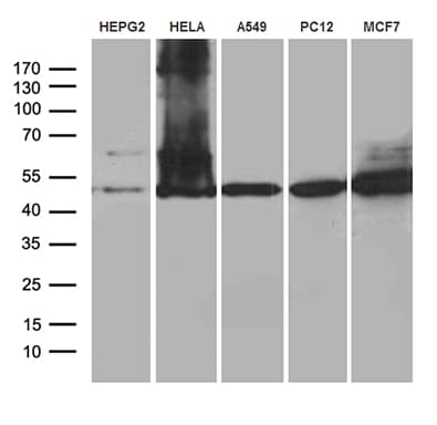 CLP1 Antibody (aa1-226, clone OTI2D2)