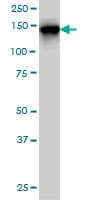 TMEM1 / TRAPPC10 Antibody (clone 5B4)