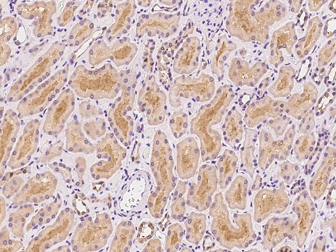 Polyclonal Rabbit anti-Human Spastic / GLRB Antibody (IHC, WB)