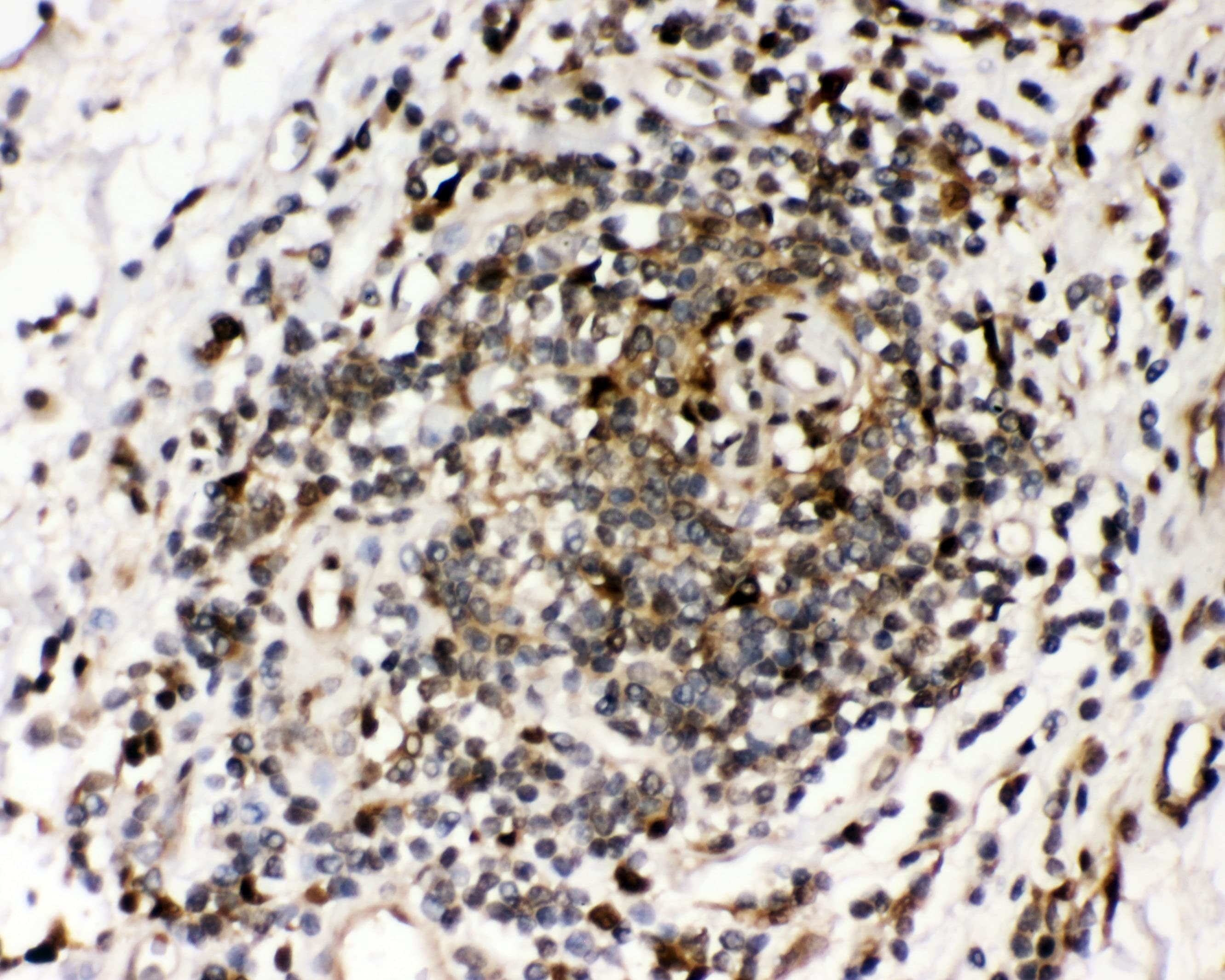 RNH1 Antibody (aa2-37)