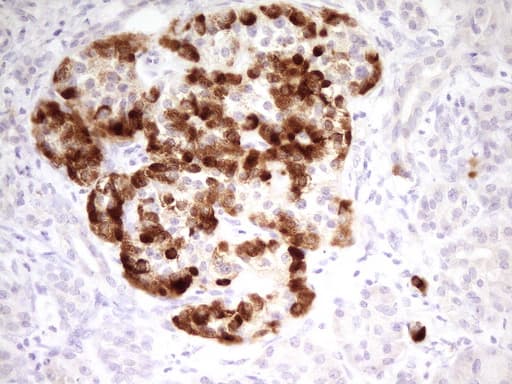 C-TAK1 / MARK3 Antibody (aa473-729, clone OTI2G8)