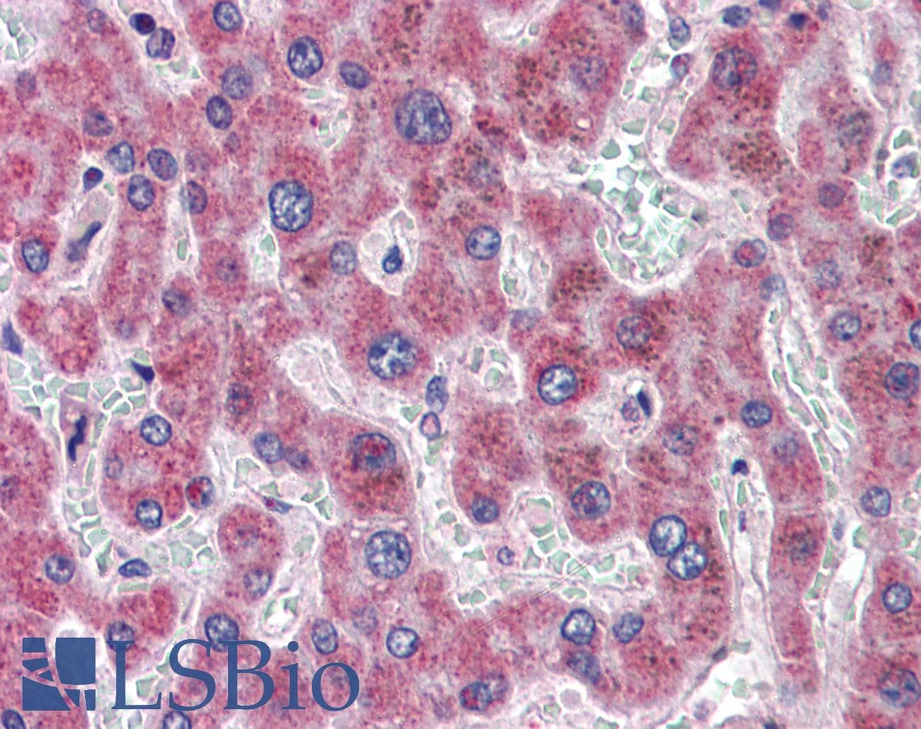 IHC-plus™ DGAT2 Antibody (aa303-316)