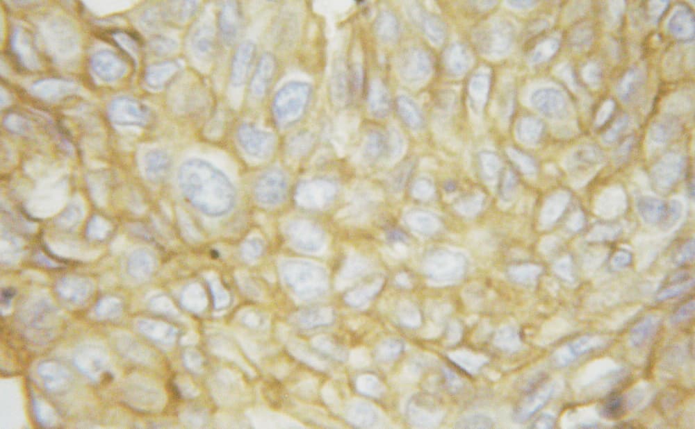 Polyclonal Rabbit anti-Human ATP1A1 Antibody (phospho-Ser16, IHC, IF, WB)