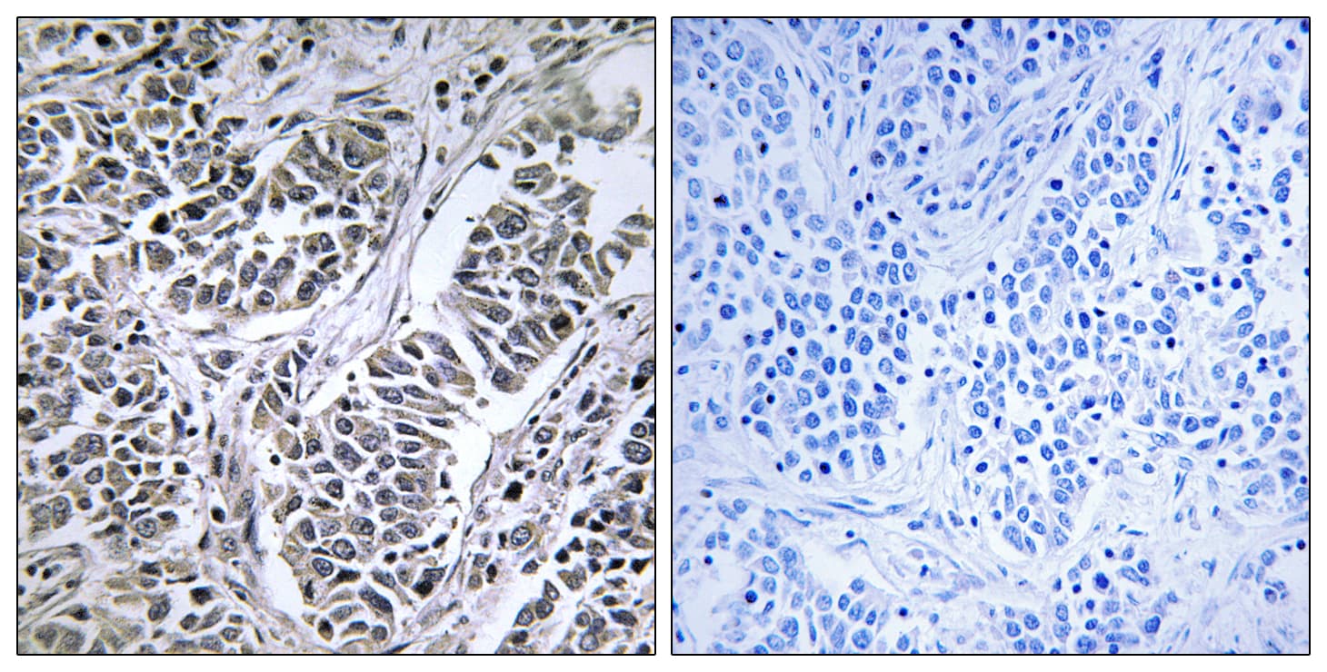 Polyclonal Rabbit anti-Human ATP5D Antibody (aa61-110, IHC, IF)