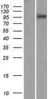 SPAG1 / TPIS Protein (Over-Expression Lysate Myc-DDK (Flag))
